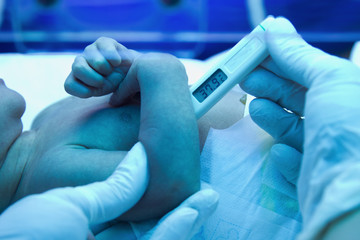 Measuring temperature to  a sick new born baby under ultraviolet