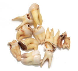 teeth with caries on a white background. macro