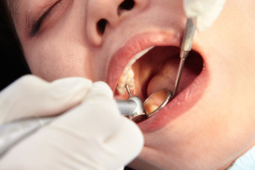 Close up teeth examination