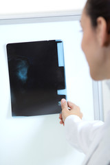 Attractive young female doctor examining x-ray results