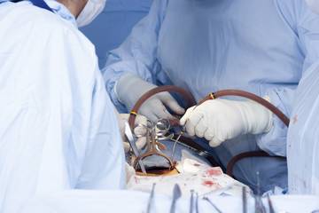 Surgical procedure