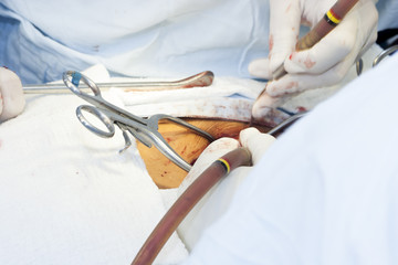 Surgical procedure