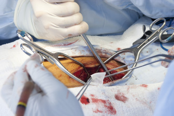 Surgical procedure