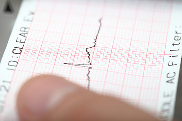 Earthquake on a seismograph.