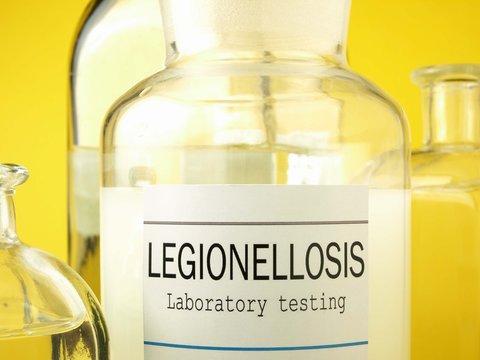 Legionella