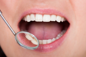 Dental Inspection