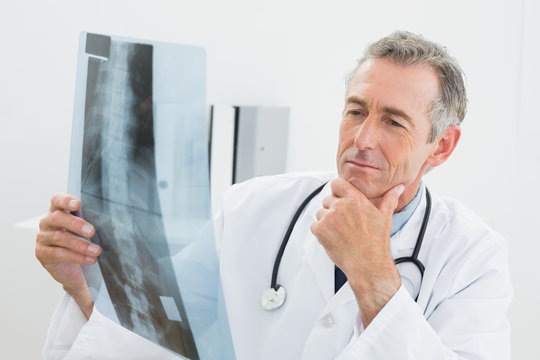 Doctor looking at x-ray picture of spine in office