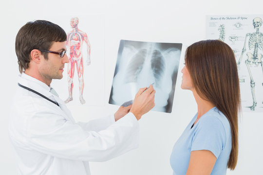 Male doctor explaining lungs x-ray to female patient
