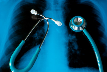 Stethoscope on an Xray photo of lungs