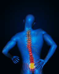 Back pain