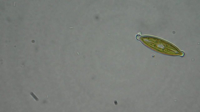 Diatom algae cells under microscope