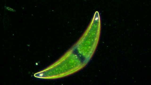 Green algae cells under microscope