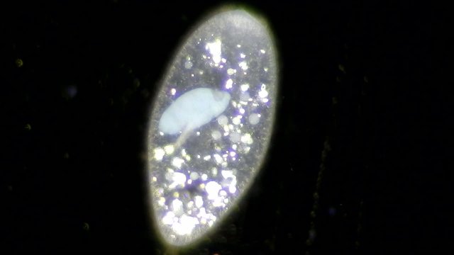 Live single-celled infusoria under microscope