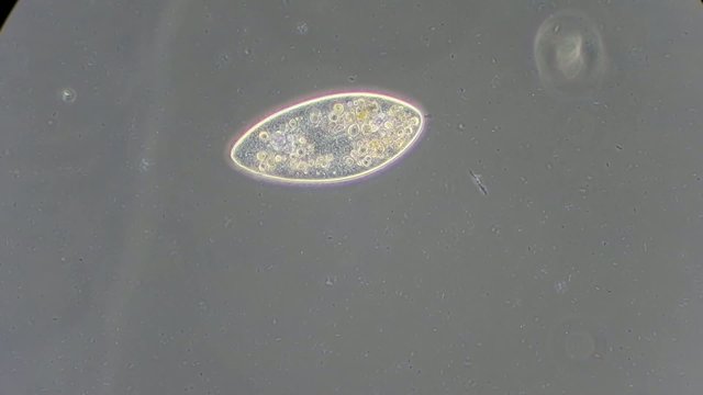 Live single-celled infusoria under microscope
