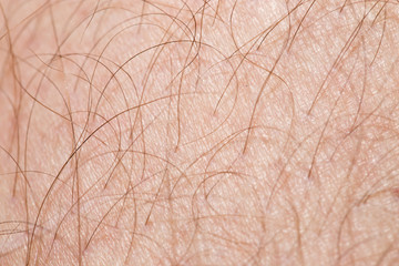 hair on the skin. macro