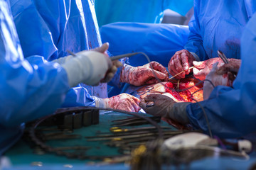 Team of surgeons performing an operation on a patient