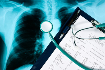 Blood test results with a clipboard and stethoscope on Xray