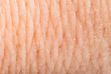 Close up human skin. Macro epidermis