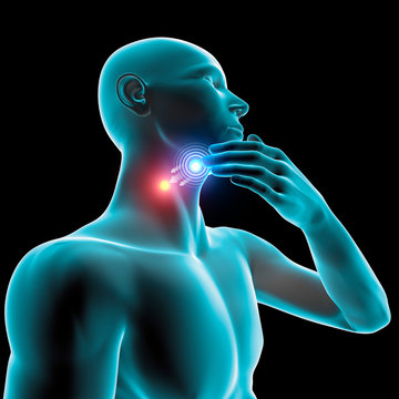 Mal di gola infiammazione arrossamento dolore, pastiglia e cura