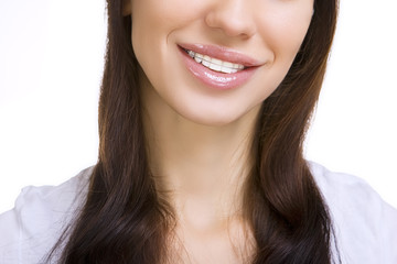 Beautiful smiling girl with retainer for teeth - obrazy, fototapety, plakaty