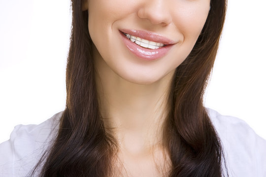 Beautiful smiling girl with retainer for teeth