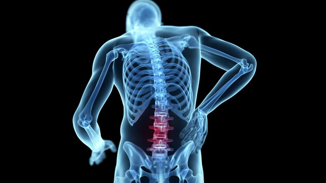 Medical animation of a man having a backache