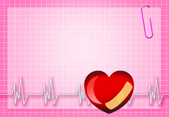 Electrocardiogram
