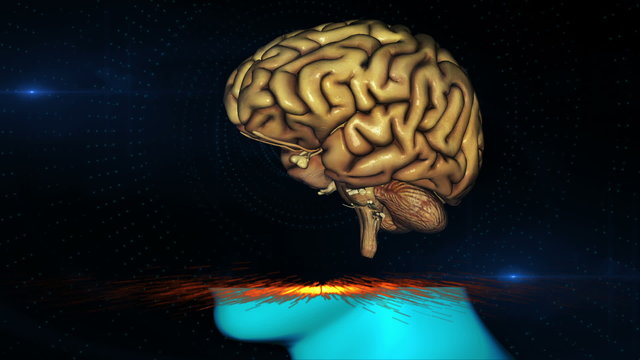 Brain scan