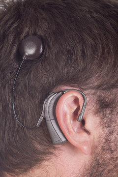close up young man with cochlear implant