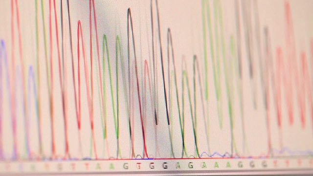 Genetic Chromatogram On A Computer Screen