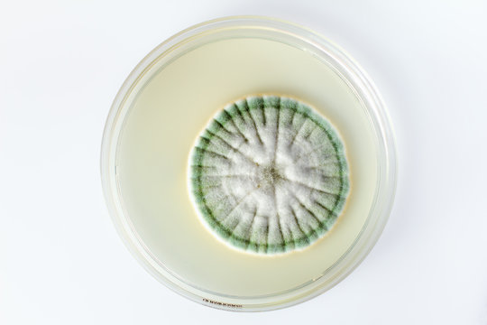 growth of a fungus in plate isolated in white