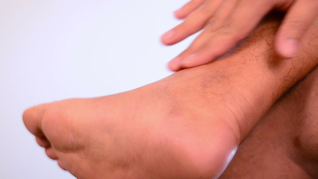 Massage sprained ankle
