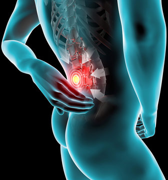 Uomo mal di schiena dolore raggi x scheletro