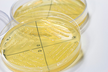 Petri dish with bacterial  colonies. .