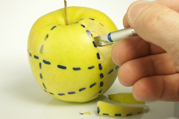 cosmetic surgery
