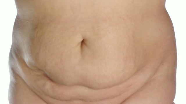 obese woman's stomach on white background