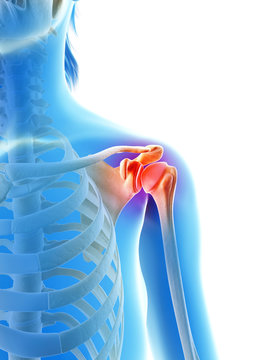 inflammation of the shoulder joint
