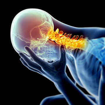 headache due to neck pain