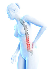 3d rendered medical illustration - Acute pain in a woman´s back.