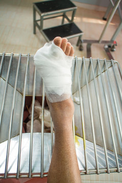 Diabetic ulcers at the foot