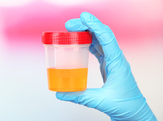 Medical urine test, close-up