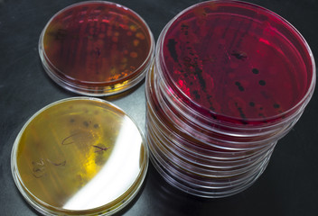 laboratory  test samples