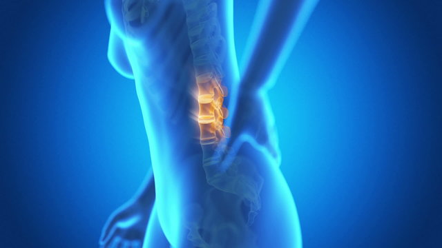 medical animation - pain in the lower back