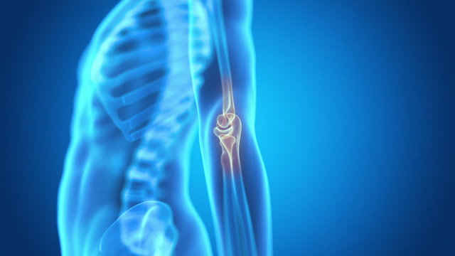 medical animation - pain in the elbow