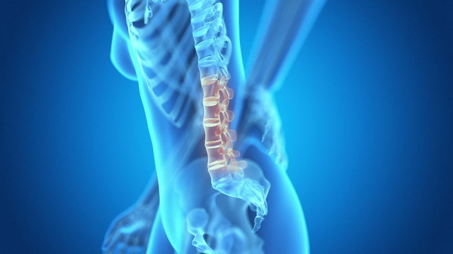 medical animation - pain in the lower back