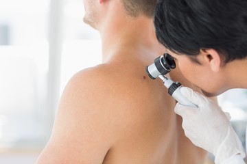 Doctor examining mole on back of man - obrazy, fototapety, plakaty