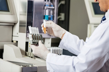 Scientist Analyzing Urine Samples In Lab