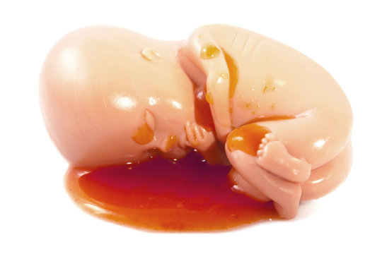The unborn