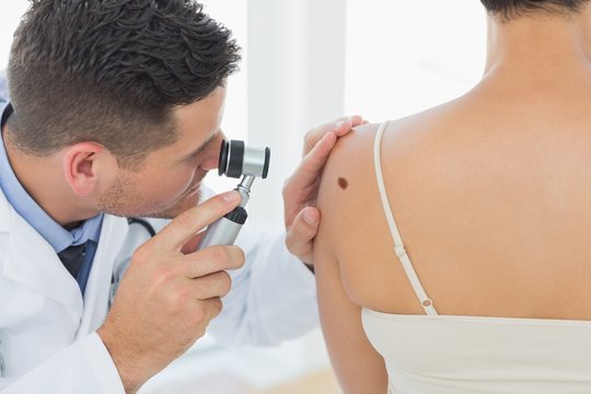 Doctor examining mole on back of woman