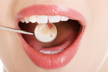 Close up on woman's open mouth